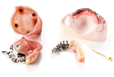 Obturatoren und implantatgetragener Zahnersatz 